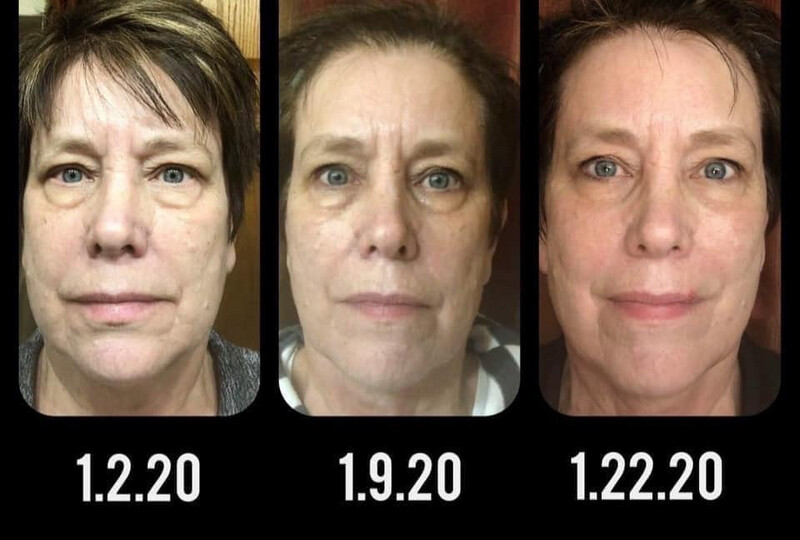 Ideal Eyes cream