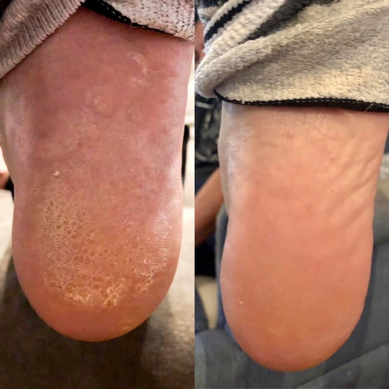 Sole Solution