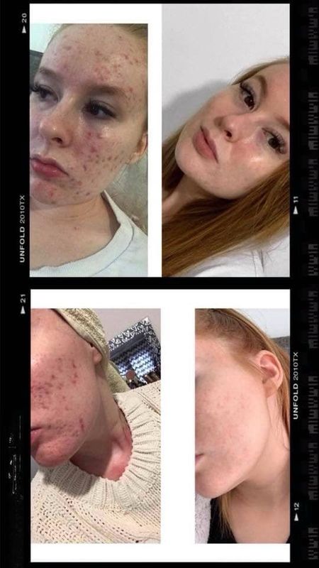 180 Vitamin C Face Wash