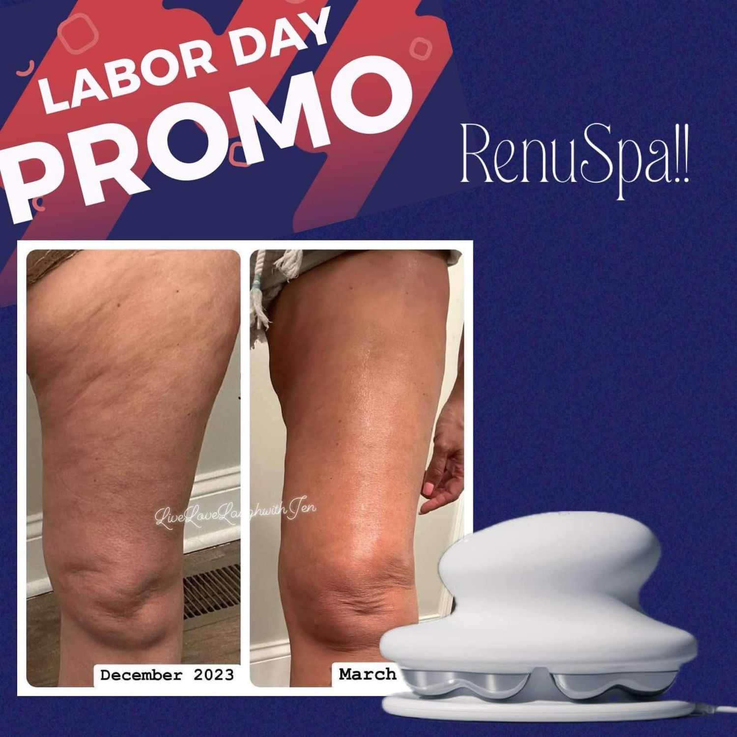 Renuspa