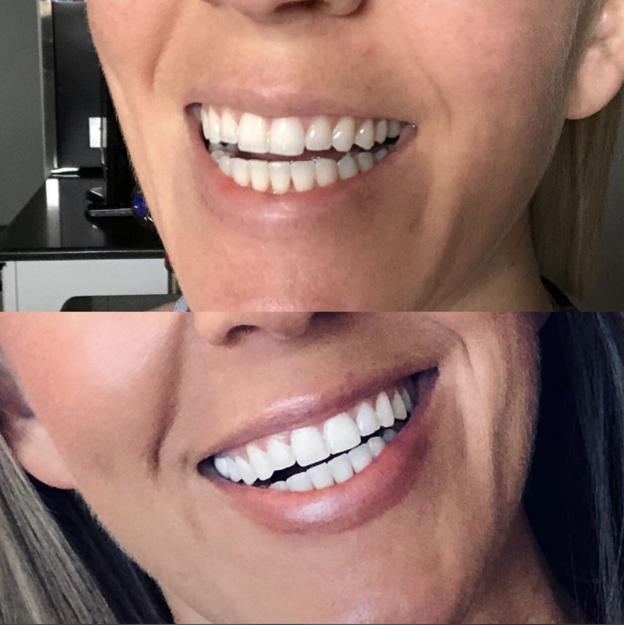 AP 24 Whitening Toothpaste