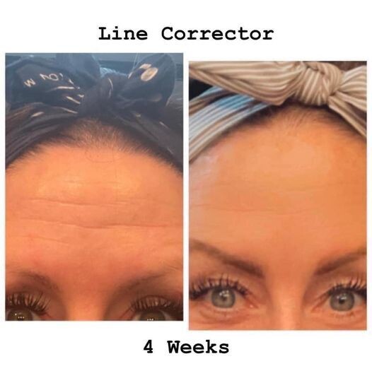 Tru Face Line Corrector