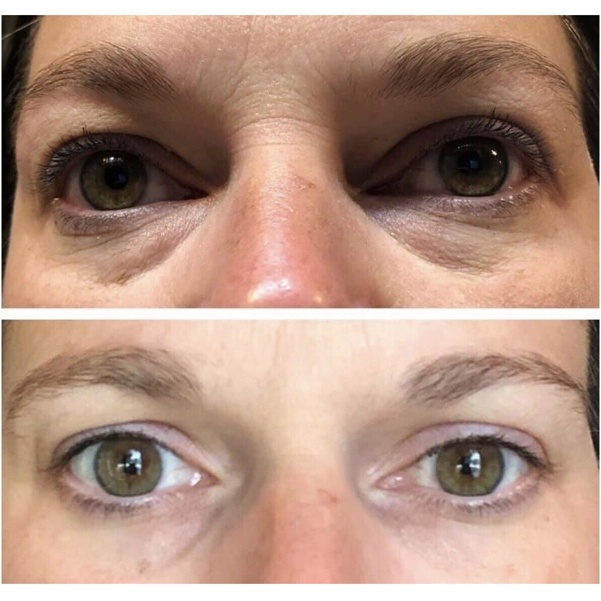 ageloc Ideal Eyes Cream