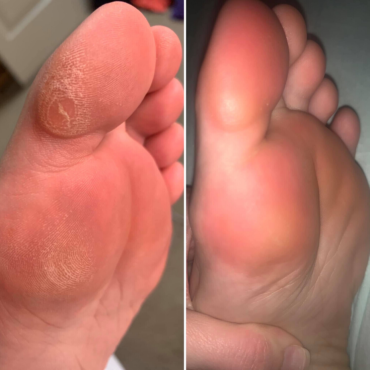 Epoch Sole Solution