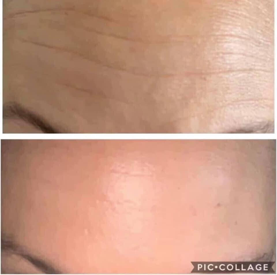 Tru Face Line Corrector