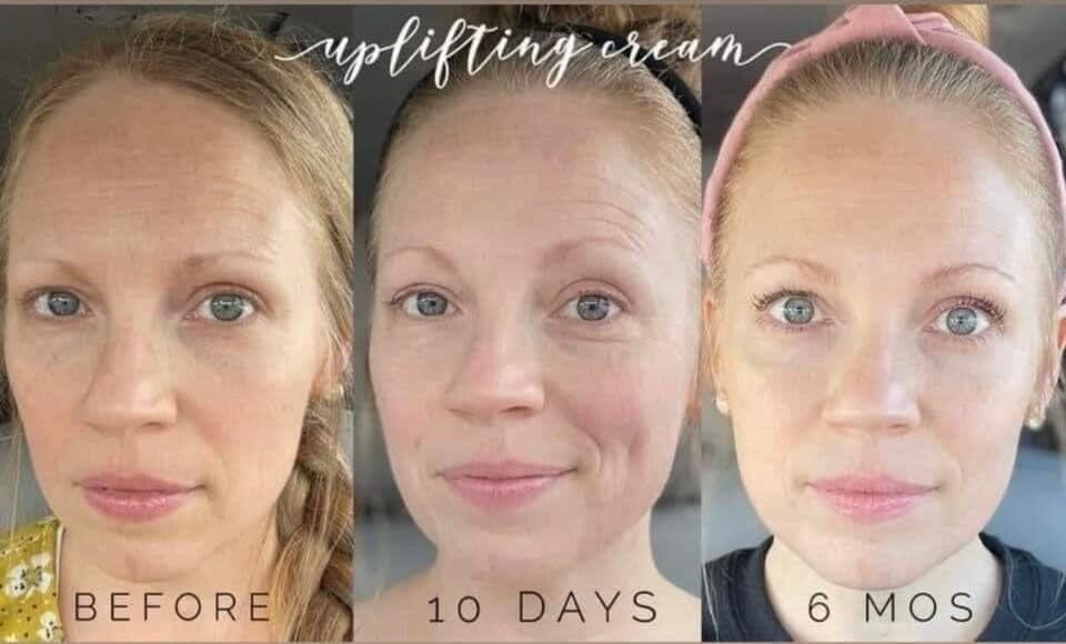 TFEU Uplifting Cream