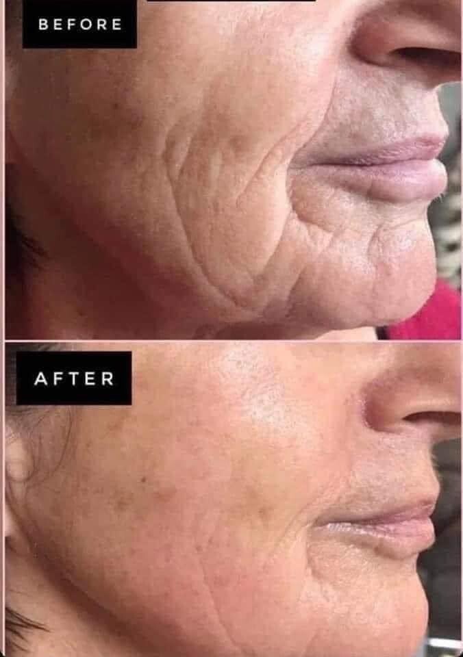 TFEU Uplifting Cream