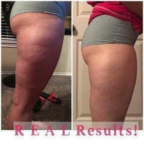 Firming Cream (ageLOC® Dermatic Effects)