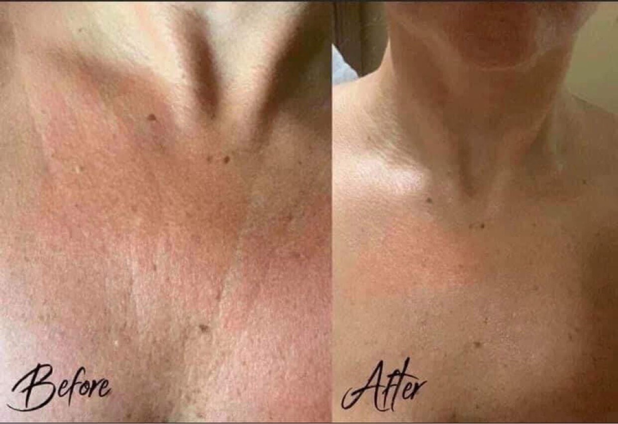 Firming Cream (ageLOC® Dermatic Effects)