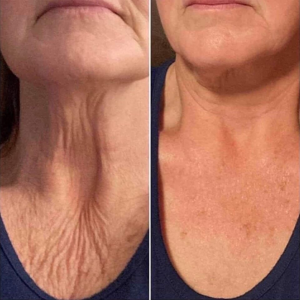 Firming Cream  3 Pack (ageLOC® Dermatic Effects)