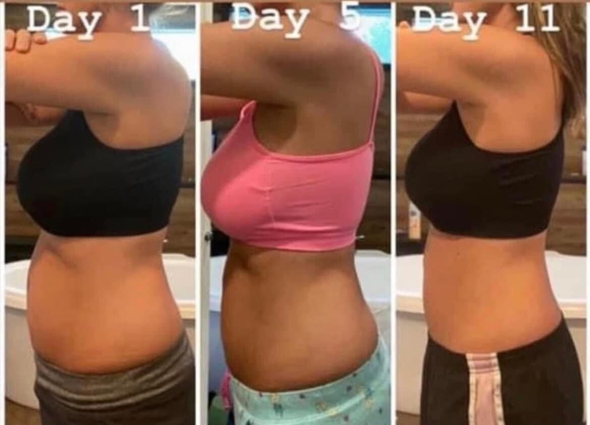 Bloat Buster  120 count (Tegreen)