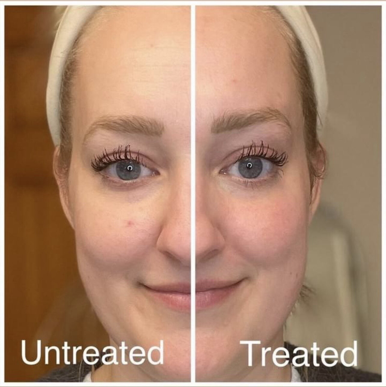 Facial Spa aka Wrinkle iron
