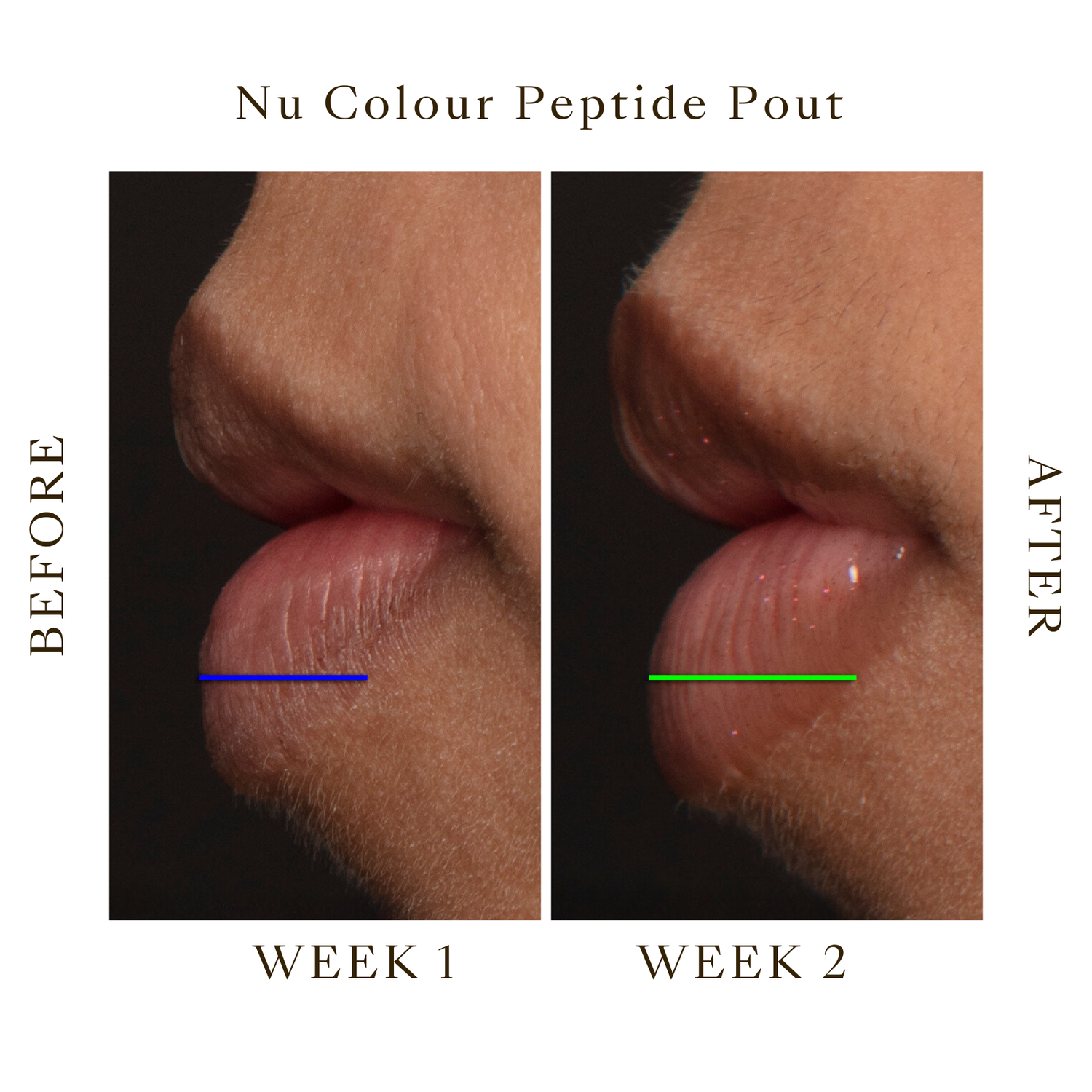Peptide Lip Pout