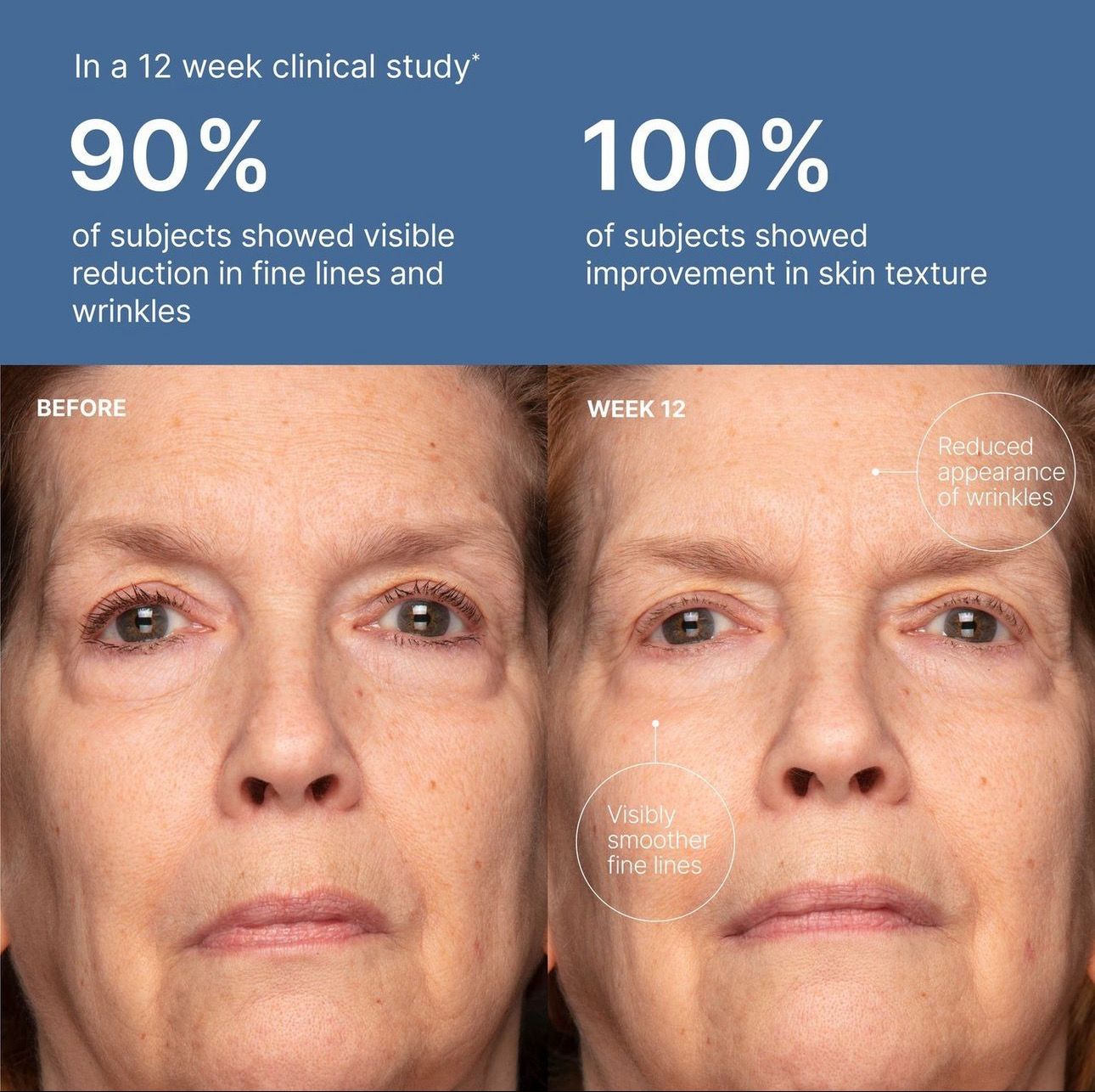 Ultimate Anti-aging Duo