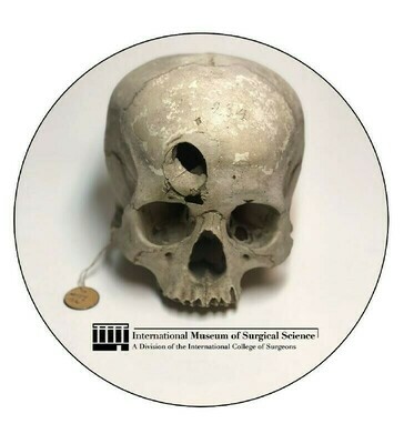 Trephined Skull Sticker