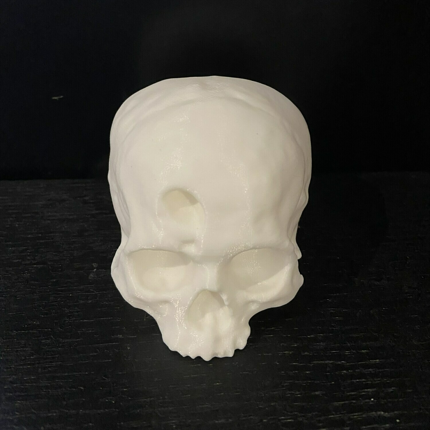 Trephined Skull 3D Print