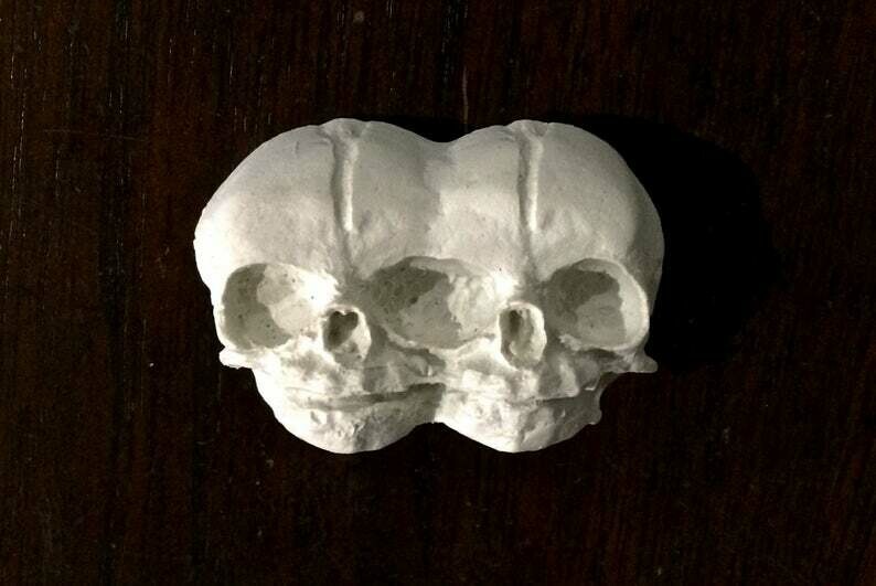 Conjoined Twins Skull Magnet