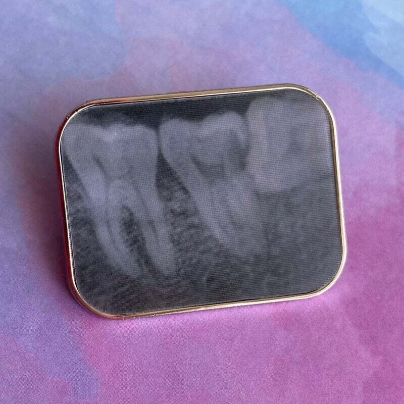 Dental X-Ray Pin