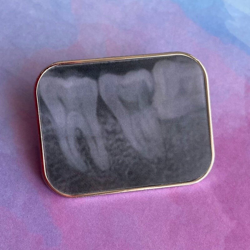 Dental X-Ray Teeth Pin