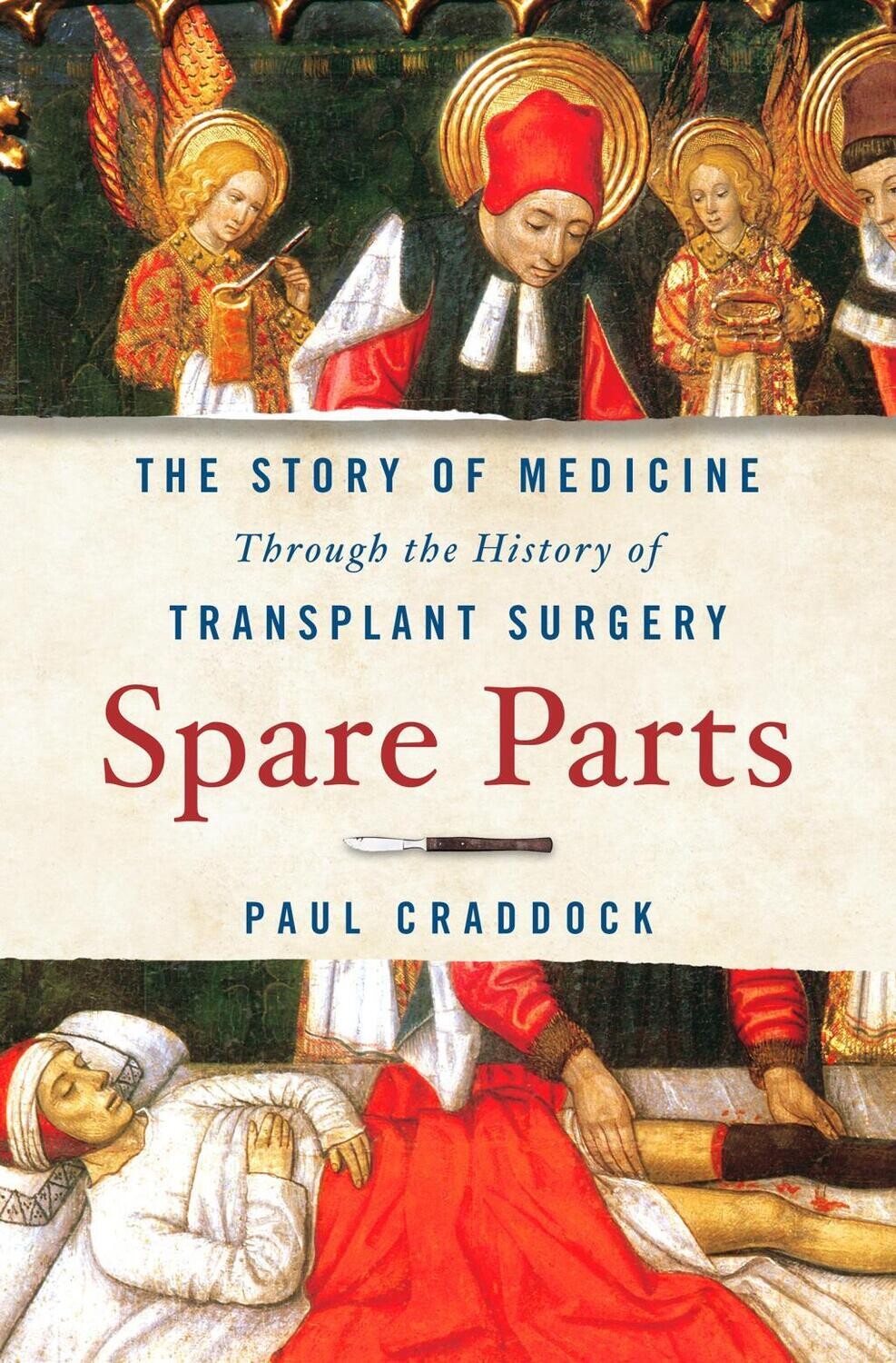 Spare Parts: The Story of Medicine Through the History of Transplant Surgery by Paul Craddock