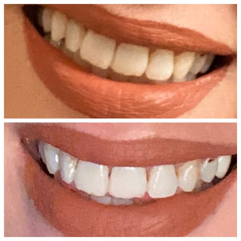 🖤 toothpaste 🖤