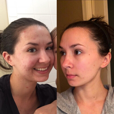 LumiSpa iO Device (w/free cleanser &amp; 2 year warranty)