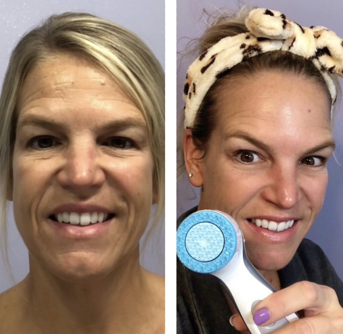 LumiSpa iO Device (w/free cleanser &amp; 2 year warranty)