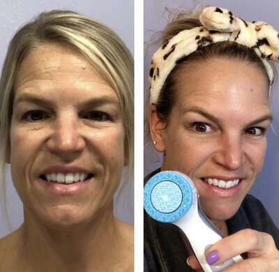 LumiSpa iO Device (w/free cleanser &amp; 2 year warranty)