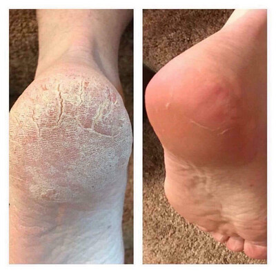 Foot Lotion (pedi in a bottle)