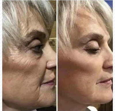 Anti-Aging Uplifting Cream Moisturizer