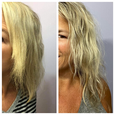 Scalp &amp; Hair System Kit (for fuller, thicker hair)