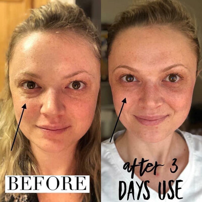 Ideal Eyes - use with or without lumispa accent