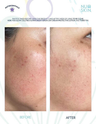 Thirst Fix Hydrating Gel Cream (Moisturizer)