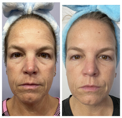 Collagen (30 day supply) - you pick on-the-go liquid pouches or mix in powder form