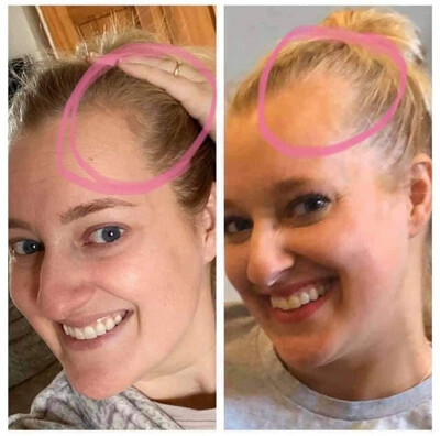 Scalp Spray for thicker hair