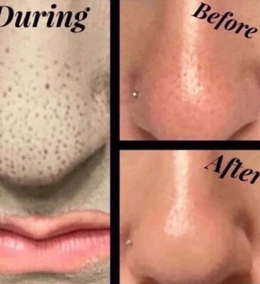 Mud Mask