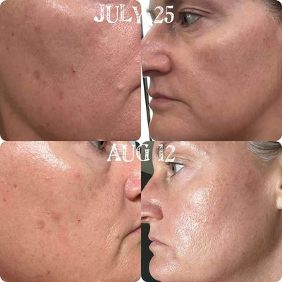 Peptide Retinol