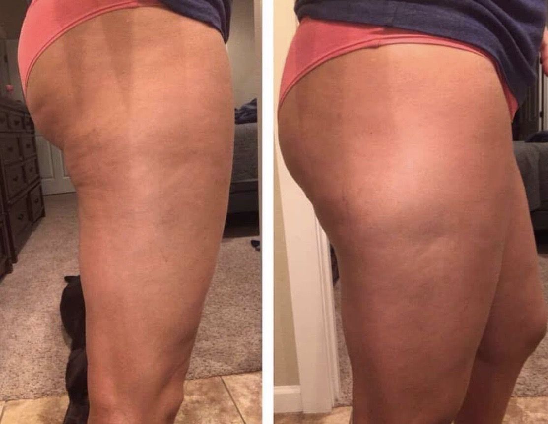 Cellulite Lotion - 3/$124