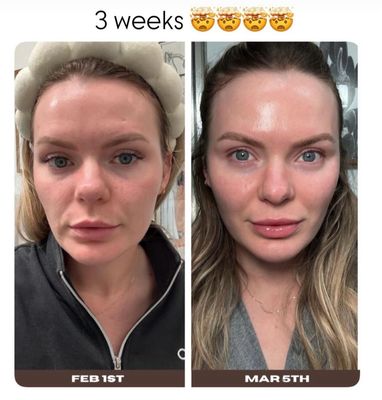 Future Serum