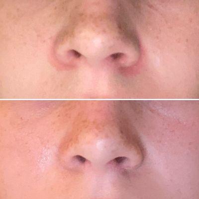 Cica Balm