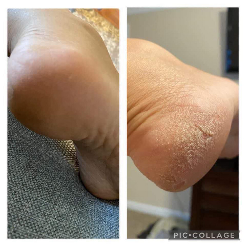 Foot Lotion &#39;Pedi in a Bottle&#39;