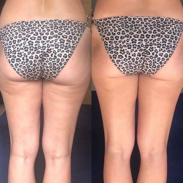 Firming/Cellulite Cream