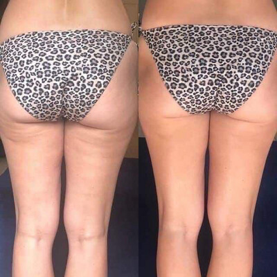 Firming/Cellulite Cream