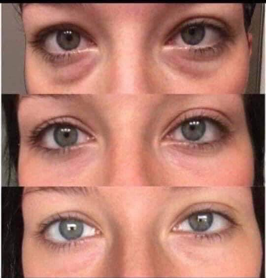 Ideal Eyes