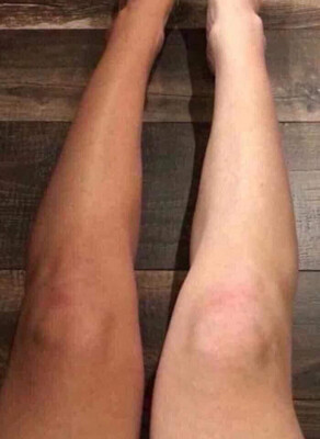 Sunless Tanner