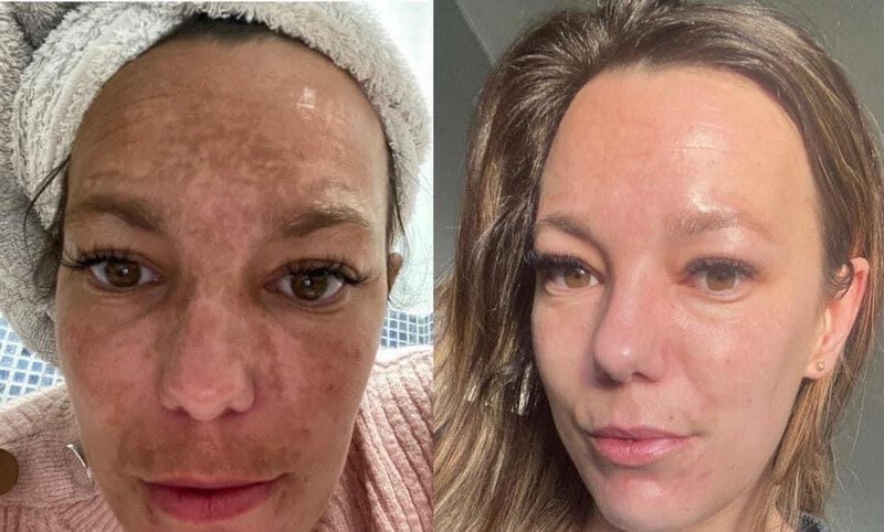 Nu Skin 180°® AHA Facial Peel and Neutralizer