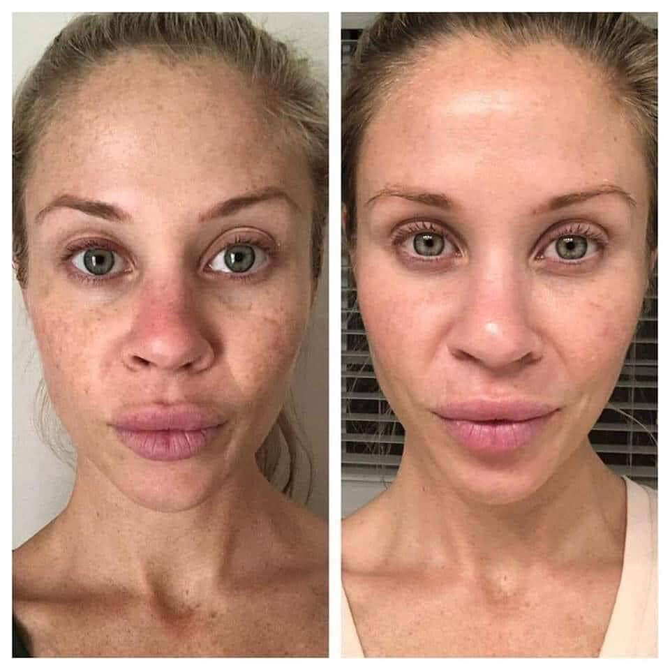 Vitamin C Facewash