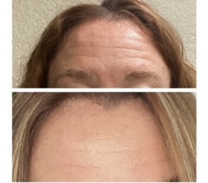 Facial Spa