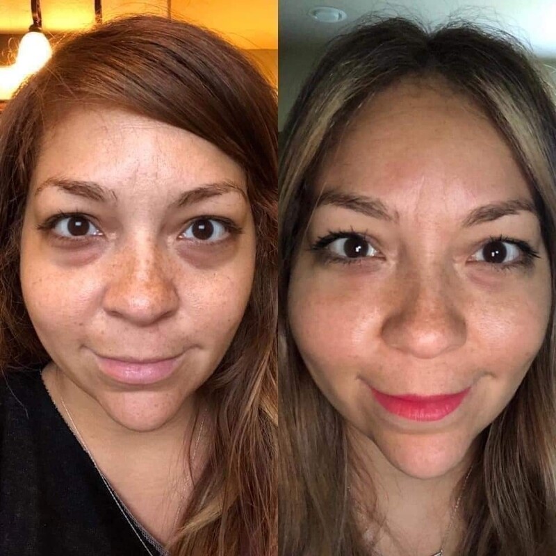 Age Loc Idealeyes