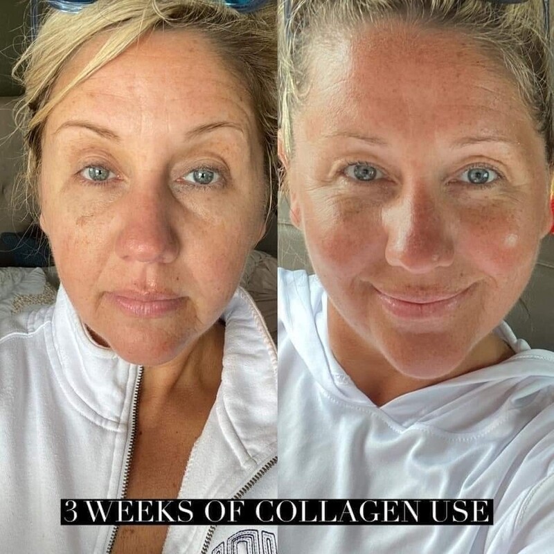 Beauty Focus™ Liquid Collagen+